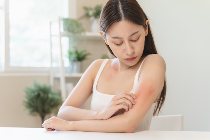 The authors conclude, 'Our findings explain how the skin’s surface prevents excessive inflammation through ZNF750- and KDM1A-mediated suppression of PRRs.'