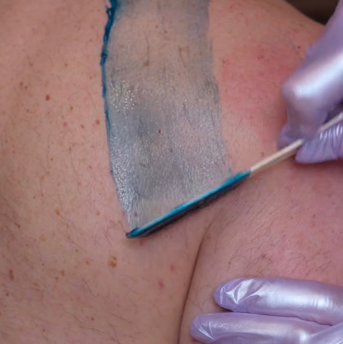 Waxing the back of a male with Lycon wax