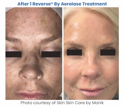 Screenshot 2024 11 19 At 6 32 08γç»am