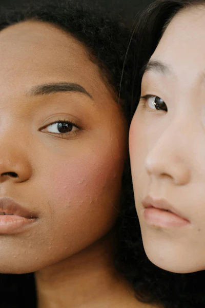 Per Spate, there has been a 1.3K jump in monthly Google searches for non-comedogenic makeup. It’s no surprise, then that, in the same 12-month period, searches for “pimple” alongside makeup have increased by 1.9K.