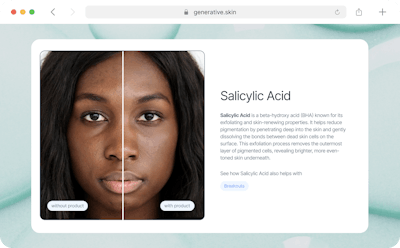 Example image of the potential long term results of using salicylic acid for skin care.