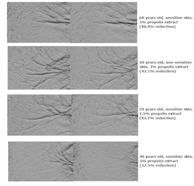 Ct2503 Tavasoli Figure 5