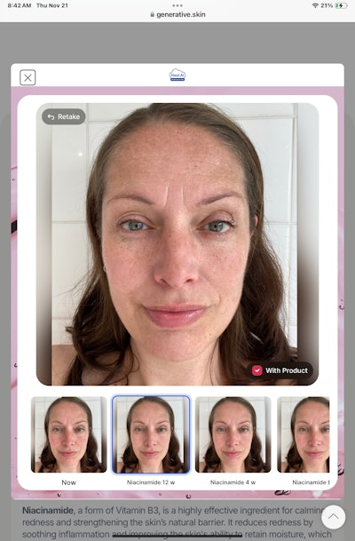 SkinGPT uses generative AI to predict how factors like UV exposure or skin care ingredients affect the skin over time, providing accurate simulations—not just filters.