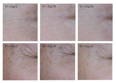 Anti-wrinkle efficacy at Day 0 and 28 and 56 days after test product application