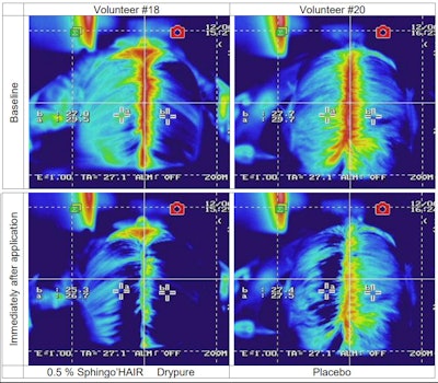 Assessment of scalp soothing (T°C) by infrared thermal imaging camera at baseline (top) versus immediately after application (bottom) with Sphingo'Hair Drypure (left) versus placebo (right)
