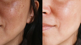 Lighting, cropping and other techniques can, intentionally or not, manipulate the appearance of efficacy in clinical testing.