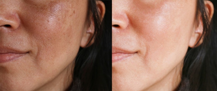 Lighting, cropping and other techniques can, intentionally or not, manipulate the appearance of efficacy in clinical testing.