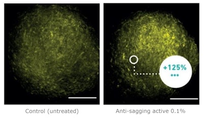 Figure 6. Density of elastic fibers in spheroid models, measured by SHGM