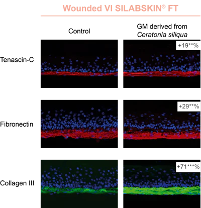 Figure 1 - Effect of GM derived from Ceratonia siliqua on the granulation tissue formation observed on wounded VI SILABSKIN FT.
