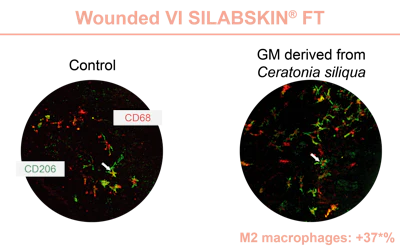 Figure 3 - Effect of GM derived from Ceratonia siliqua on the presence of pro-inflammatory M2 macrophages observed on wounded VI SILABSKIN FT.