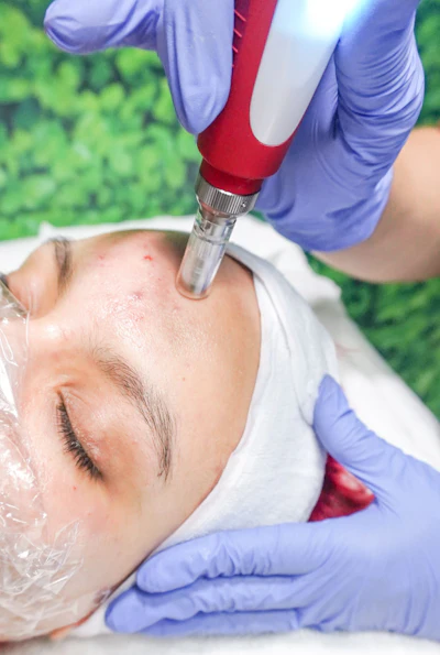 Croda's Matrixyl Neolide's 'clinically proven synergy with microneedling amplifies collagen I by 15% and collagen III by 31% versus dermaroller with a placebo, transforming the post-procedure window into a results-enhancing opportunity,' says Anne Young, Croda's technical business development manager.