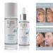 Lura skincare products with before-and-after results showing proaging and acne treatment benefits
