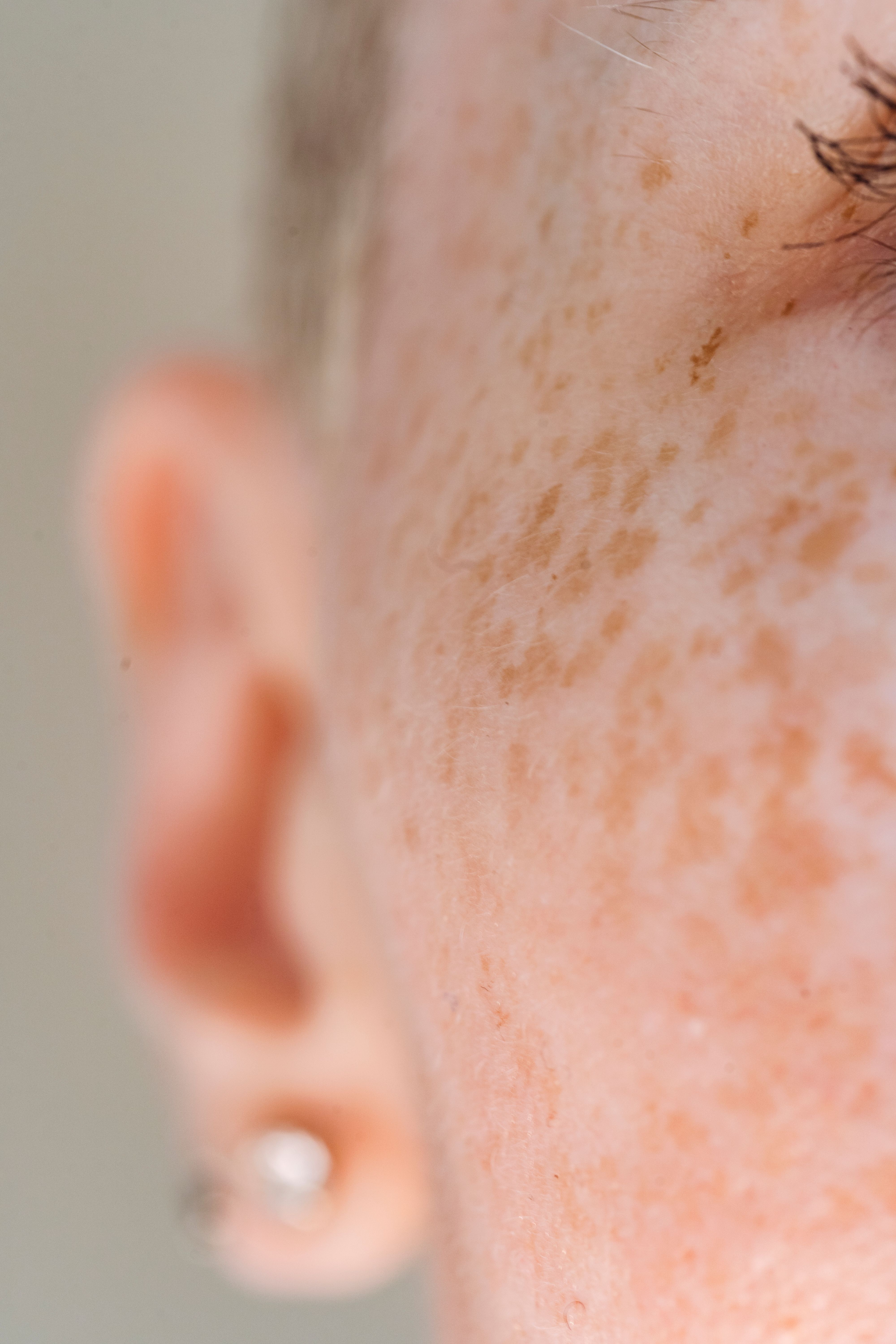 Outer Bio is positioning Yuna as a platform for identifying previously unknown mechanisms and molecules in living human skin, rather than primarily optimizing familiar cosmetic actives or delivery systems. The company says its objective is to discover new mechanisms of action and the compounds that drive them.