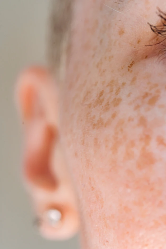 Outer Bio is positioning Yuna as a platform for identifying previously unknown mechanisms and molecules in living human skin, rather than primarily optimizing familiar cosmetic actives or delivery systems. The company says its objective is to discover new mechanisms of action and the compounds that drive them.
